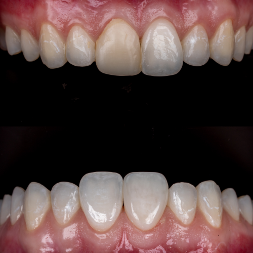 Dentist-Watkinsville-GA-Hall-Dental-Watkinsville-GA-Dentist-Dentist-3_M3qYew2