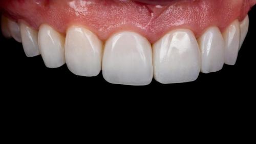 Dentist_Watkinsville_GA_Hall_Dental_Watkinsville_GA_Dentist_Dentist_3_Gmpjo8D