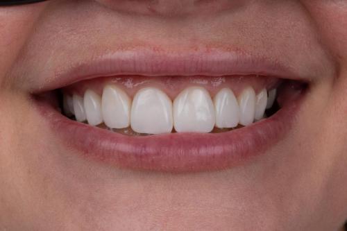 Dentist_Watkinsville_GA_Hall_Dental_Watkinsville_GA_Dentist_Dentist_3_OQ13jFR